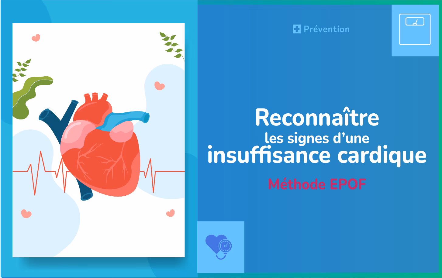 Vignette de l'article Reconnaître les signes d'une insuffisance cardiaque, méthode EPOF